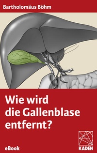 Enlarge image Cover: Wie wird die Gallenblase entfernt? - Kaden, R