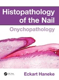 Cover: Histopathology of the Nail - CRC Press
