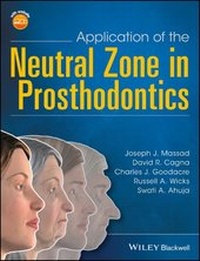 Abbildung von: Application of the Neutral Zone in Prosthodontics - Wiley-Blackwell