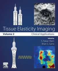 Enlarge image Cover: Tissue Elasticity Imaging - Elsevier