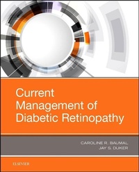 Enlarge image Cover: Current Management of Diabetic Retinopathy - Elsevier