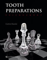 Abbildung von: Tooth Preparations - Quintessence Publishing Co. Ltd.