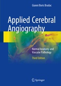 Abbildung von: Applied Cerebral Angiography - Springer