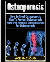 Abbildung von: Osteoporosis - Pro Mastery Publishing
