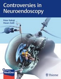 Abbildung von: Controversies in Neuroendoscopy - Thieme Publishers