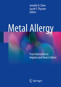 Abbildung von: Metal Allergy - Springer