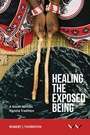 Cover: Healing the Exposed Being - Wits University Press