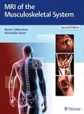 Cover: MRI of the Musculoskeletal System - Thieme