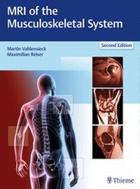 Abbildung von: MRI of the Musculoskeletal System - Thieme