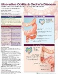 Cover: Ulcerative Colitis & Crohn's Disease - Lippincott Williams and Wilkins