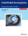Cover: Endothelial Keratoplasty - Thieme Publishers