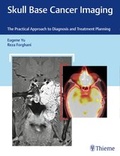 Cover: Skull Base Cancer Imaging - Thieme Publishers