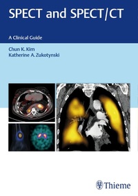 Abbildung von: SPECT and SPECT/CT - Thieme Publishers
