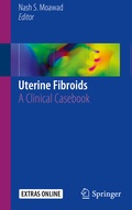 Cover: Uterine Fibroids - Springer