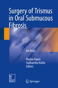 Cover: Surgery of Trismus in Oral Submucous Fibrosis - Springer
