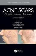Cover: Acne Scars - CRC Press
