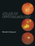 Cover: Atlas of Ophthalmology - Kluwer Academic Publishers