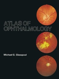 Enlarge image Cover: Atlas of Ophthalmology - Kluwer Academic Publishers