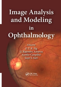 Enlarge image Cover: Image Analysis and Modeling in Ophthalmology - CRC Press