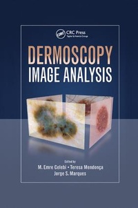Enlarge image Cover: Dermoscopy Image Analysis - CRC Press