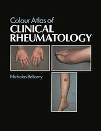 Enlarge image Cover: Colour Atlas of Clinical Rheumatology - Springer