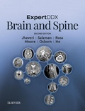 Cover: ExpertDDx: Brain and Spine E-Book - Elsevier
