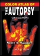 Enlarge image Cover: Color Atlas of the Autopsy on CD-ROM - CRC Press
