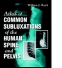 Abbildung von: Atlas of Common Subluxations of the Human Spine & Pelvis - CRC Press