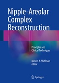 Cover: Nipple-Areolar Complex Reconstruction - Springer