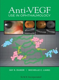 Abbildung von: Anti-Vegf Use in Ophthalmology - Slack