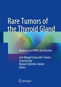 Abbildung von: Rare Tumors of the Thyroid Gland - Springer