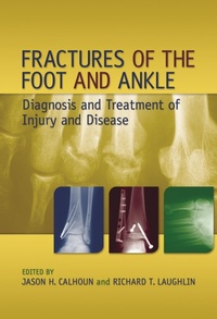 Abbildung von: Fractures of the Foot and Ankle - CRC Press