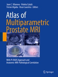 Abbildung von: Atlas of Multiparametric Prostate MRI - Springer