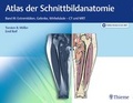 Cover: Atlas der Schnittbildanatomie - Thieme