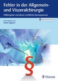 Cover: Fehler in der Allgemein- und Viszeralchirurgie - Thieme