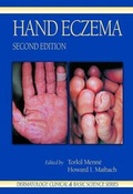 Cover: Hand Eczema - CRC Press