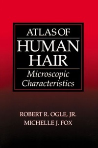 Abbildung von: Atlas of Human Hair Microscopic Characteristics - CRC Press