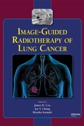 Cover: Image-Guided Radiotherapy of Lung Cancer - CRC Press