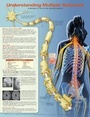 Cover: Understanding Multiple Sclerosis Anatomical Chart - Lippincott Williams and Wilkins