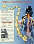 Cover: Understanding Multiple Sclerosis Anatomical Chart - Lippincott Williams and Wilkins
