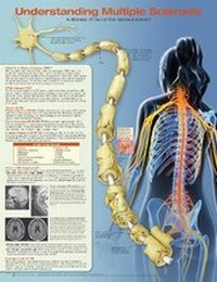 Enlarge image Cover: Understanding Multiple Sclerosis Anatomical Chart - Lippincott Williams and Wilkins