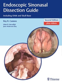 Abbildung von: Endoscopic Sinonasal Dissection Guide - Thieme Publishers