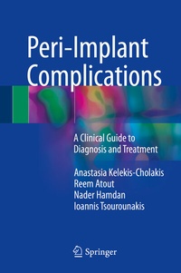 Abbildung von: Peri-Implant Complications - Springer