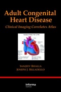 Cover: Adult Congenital Heart Disease - CRC Press