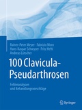 Cover: 100 Clavicula-Pseudarthrosen - Springer