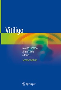 Abbildung von: Vitiligo - Springer
