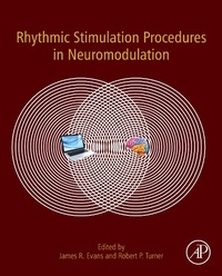 Bild: Rhythmic Stimulation Procedures in Neuromodulation - Academic Press