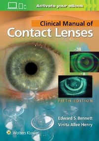 Abbildung von: Clinical Manual of Contact Lenses - Lippincott Williams and Wilkins