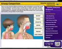 Abbildung von: Pediatric Respiratory Emergencies Web Version - Jones and Bartlett Publishers, Inc