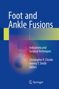 Abbildung von: Foot and Ankle Fusions - Springer